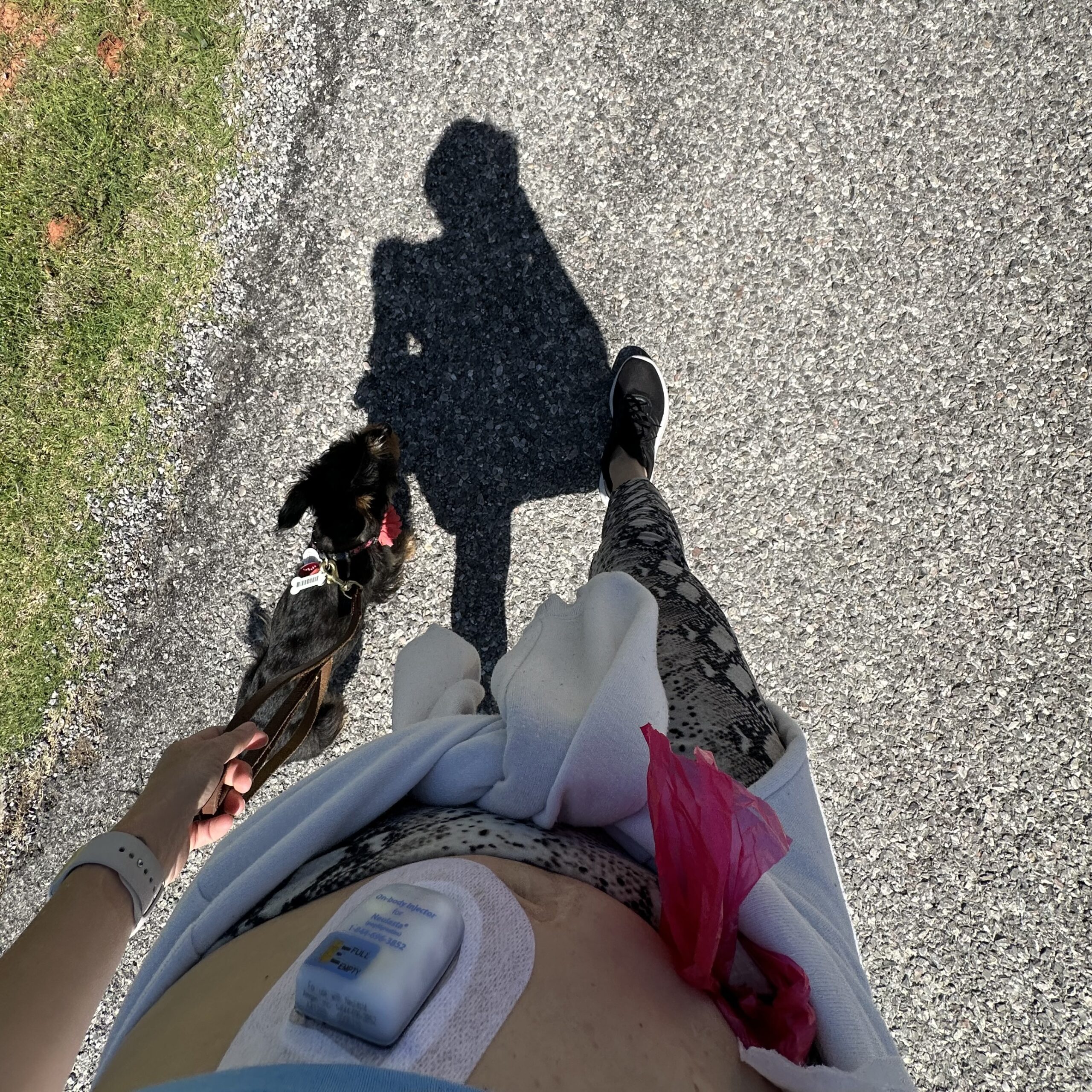 You are currently viewing My Chemotherapy Journey: Neulasta On-body Injector Review and Iron Infusion Experience